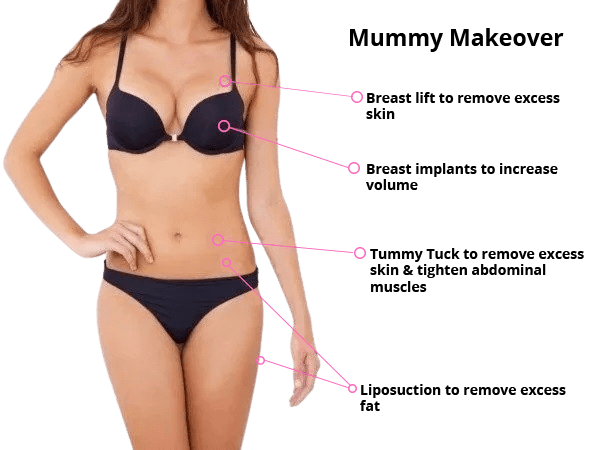 mummy makeover surgery with Medi Makeovers