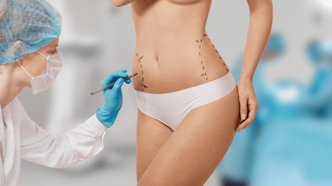 10 Things You Wish You Knew Before Your Tummy Tuck Surgery